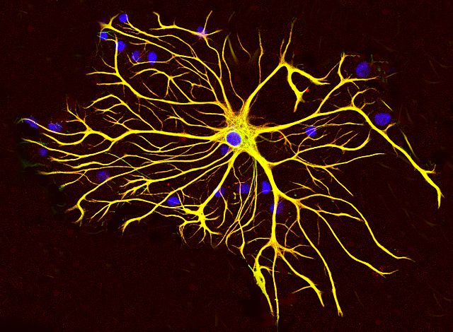 <strong>Brain glue.</strong> Neuromorphic computing systems are inspired by human neurobiology like this astrocytic glial cell (glial = glue). Courtesy Gerry Shaw. <a href='https://creativecommons.org/licenses/by-sa/3.0/deed.en'>(CC BY-SA 3.0)</a>